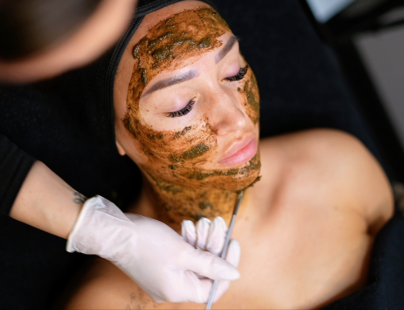 behandeling-biopeel1