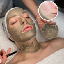 cta_biopeel
